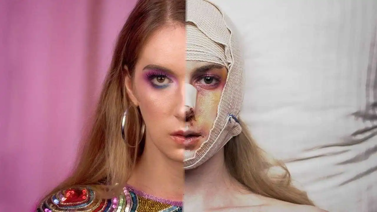 facial feminization surgerty in iran